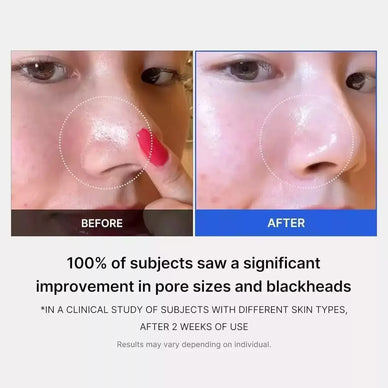 Achieve Radiant Confidence with Effortless Clarity